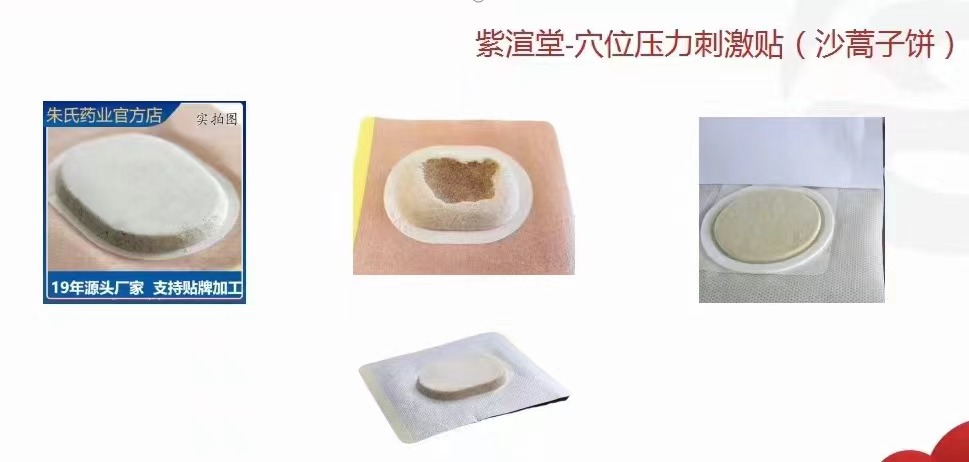 紫渲堂-穴位压力刺激贴（沙蒿子饼）